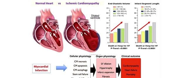 heart attack disease